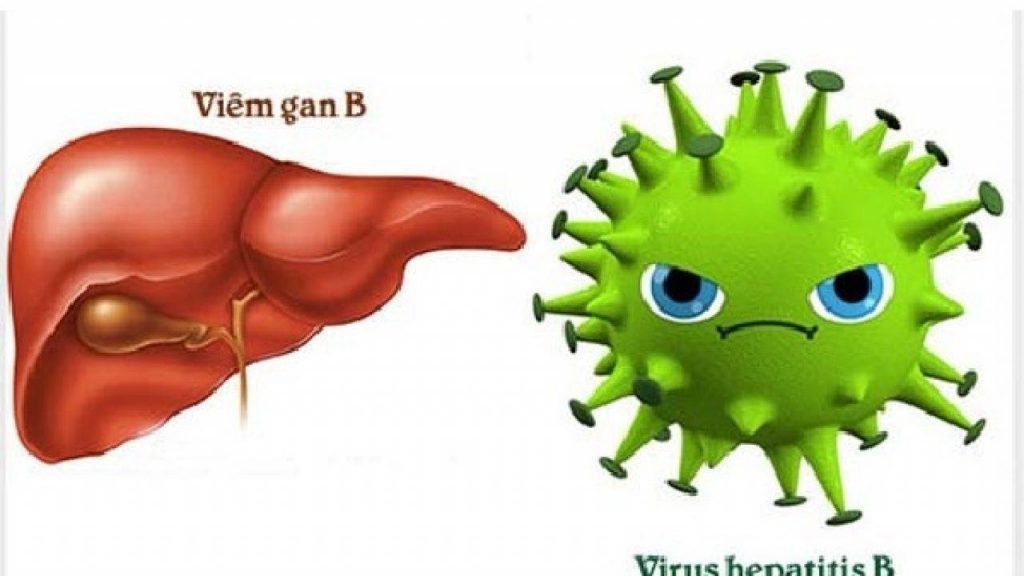 Viêm gan B – Dấu hiệu của bệnh và các triệu chứng